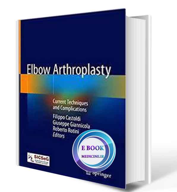 دانلود کتاب Elbow Arthroplasty: Current Techniques and Complications 1st ed. 2020 (ORIGINAL PDF)